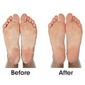 The Callus Removing Foot Treatment